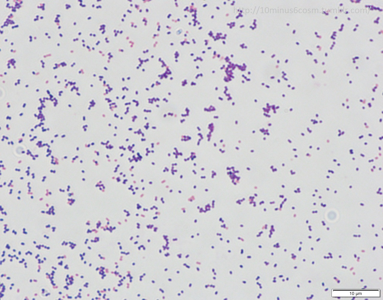 MICROCOSM | Streptococcus minor. More zoonotic Streptococcal...