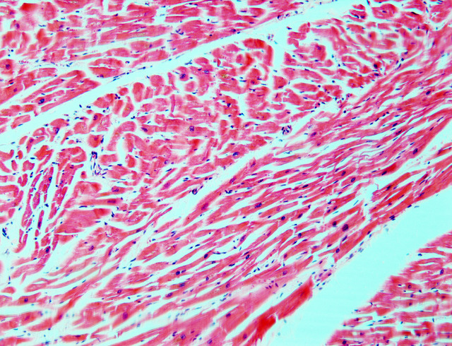 Simply Histology — Cardiac muscle stained with H&E. Higher power view...