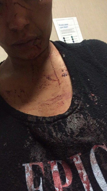 getinmelanin011:angryhijabi:MUSLIM WOMAN SAVAGELY BEATEN FOR...