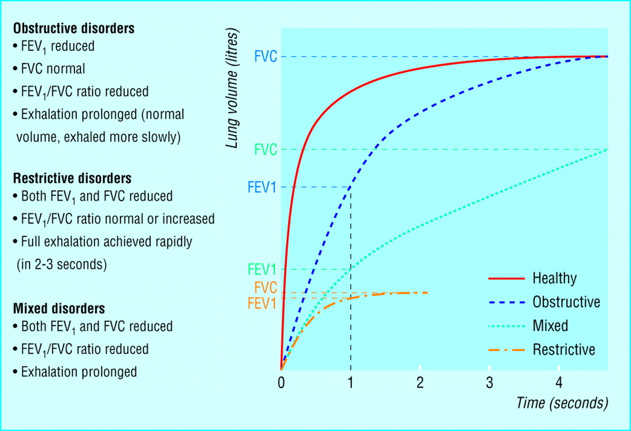 Medicineisnotmerchandise Spirometry FEV1 FVC USMLE Notebook
