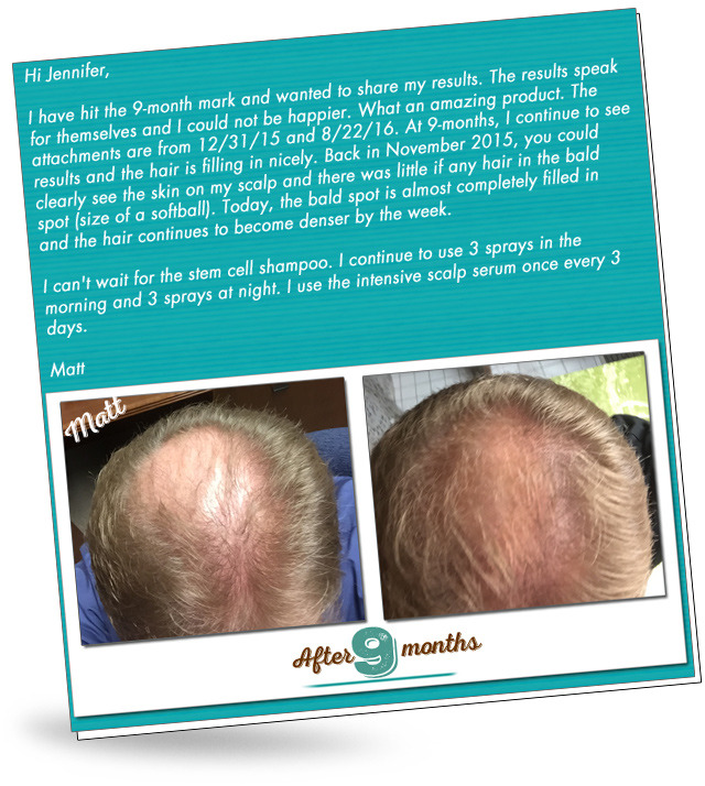 More Hair Naturally Here S An Email We Just Got From A Client
