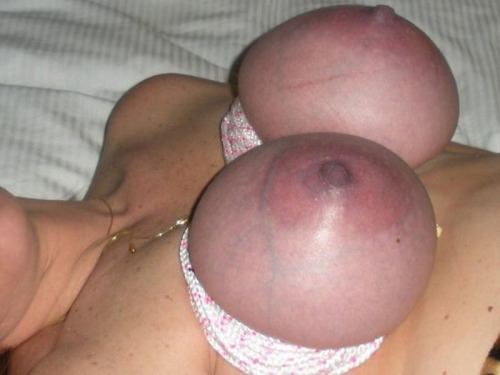 punishedbosoms:Bound, bitten, beaten,bruised, abused, sewn,...