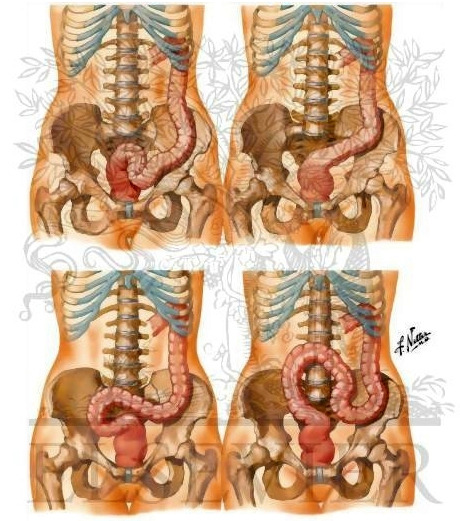 460px x 521px - Anatomy of deep anal fisting - Excellent porn