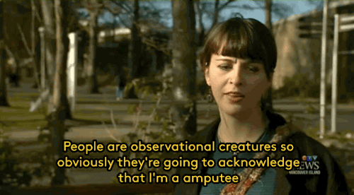prosthesis prosthetics amputee body positive fashion style gifs
