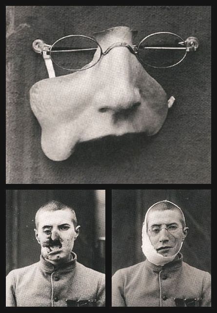 divinedisease:World war I soldier facial prosthetics