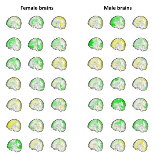 ascaloner:micdotcom:Male and female brains aren’t wired...