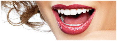 carillas dentales badalona