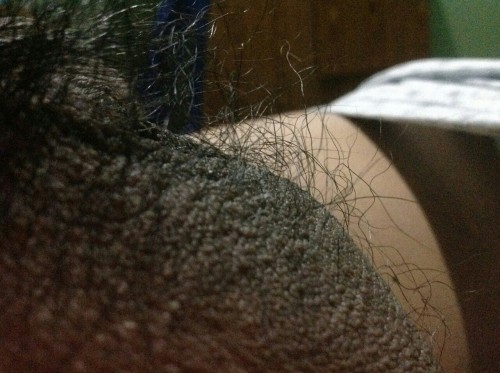 Hairy…