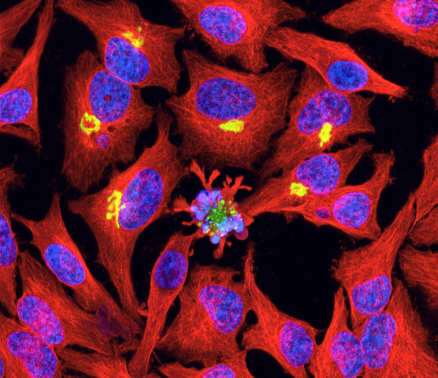 Science Visualized • Apoptosis Programmed Cell Death “remodeling To