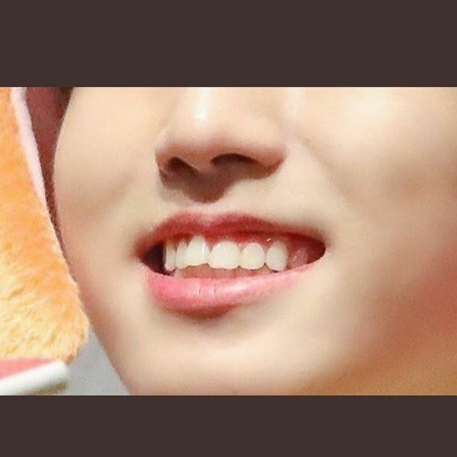 SKZ WRLD🛫 — jisung's crooked teeth and seungmin mole