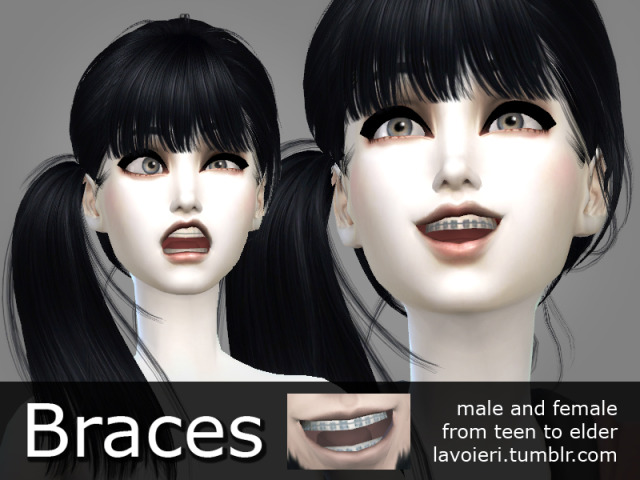 Applie's CC Finds : lavoieri: Braces for The Sims 4 • 5 color...