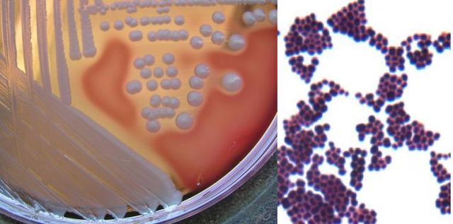 Microculture — This Weeks Microbe Staphylococcus Aureus