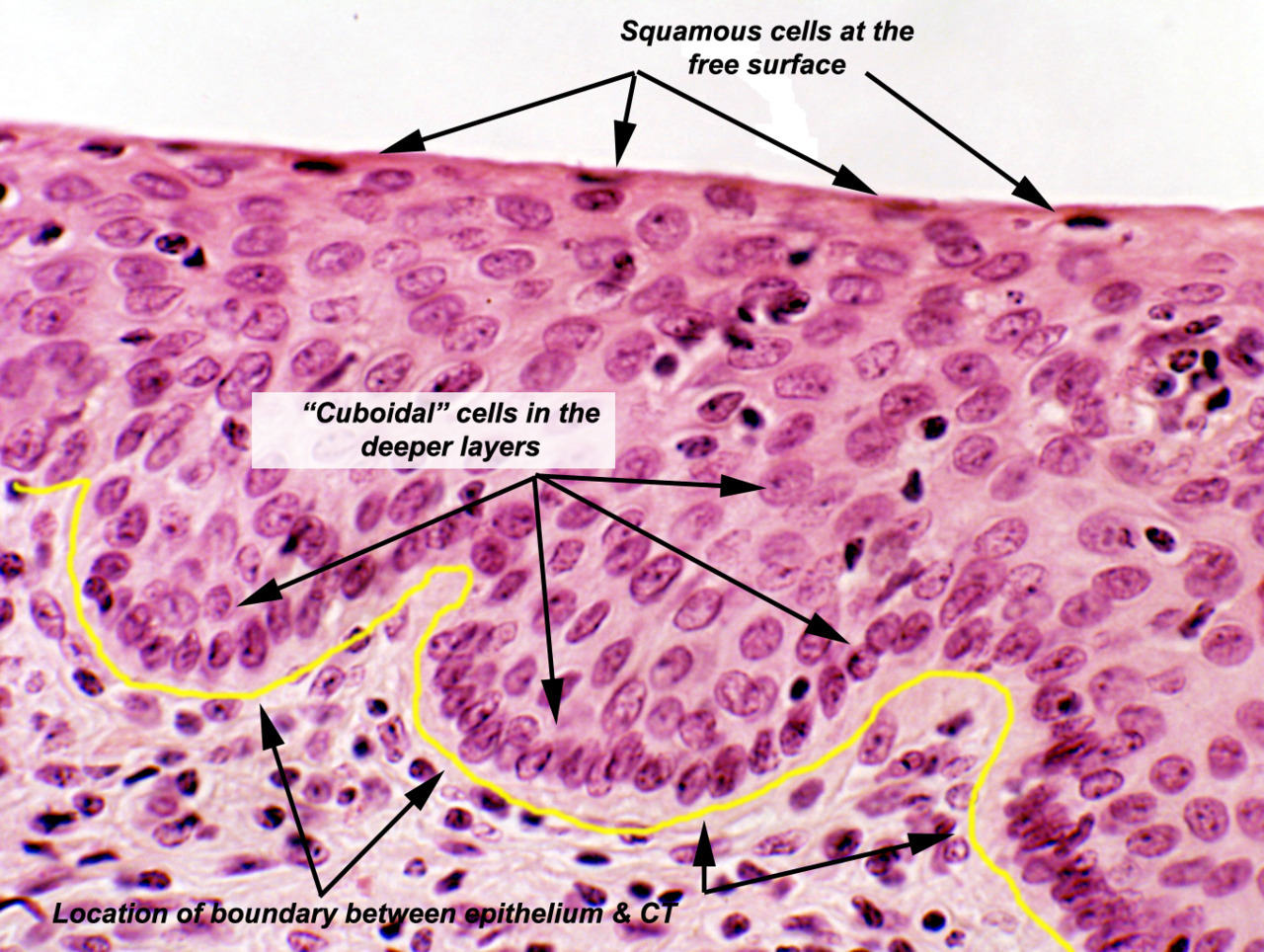 Epithelial Tissue Locations Stratified Squamous Epithelium Histology ...