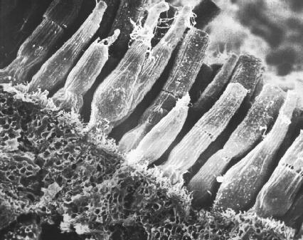 Medical School • Electron microscope image of Rods and Cones