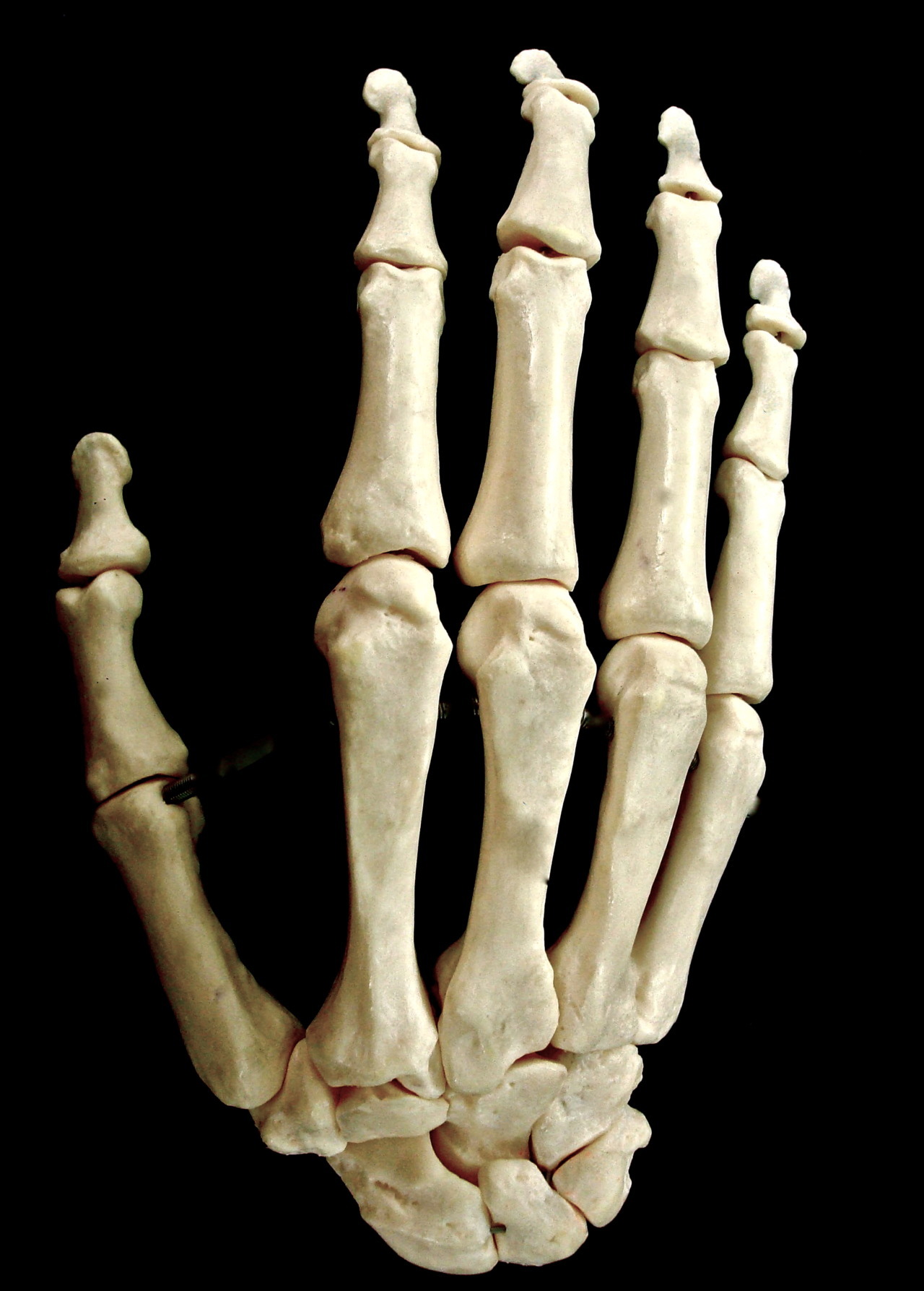 chief-teaches-anatomy-carpals-metacarpals-phalanges-carpal-mnemonic