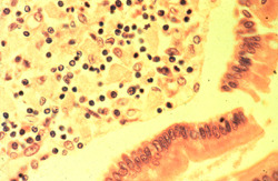 USMLE Pathology Slides