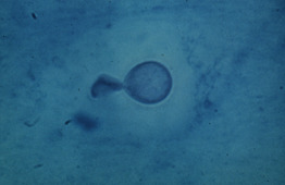 cryptococcus neoformans india ink