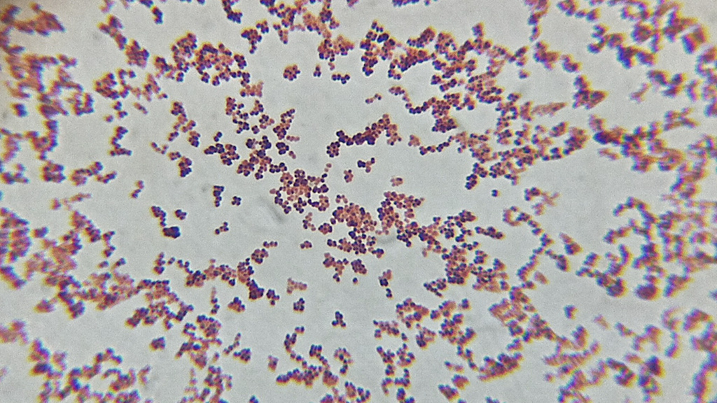 fotograffic | Photoaday126: Micrococcus Luteus. This is gram...