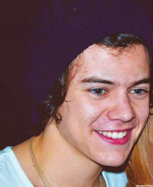 Harry styles acne tumblr