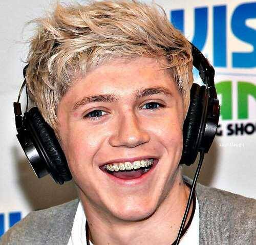 Niall Horan Braces On Tumblr 7646