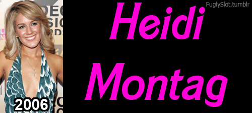 before and after heidi montag human barbie plastic surgery the hills mine