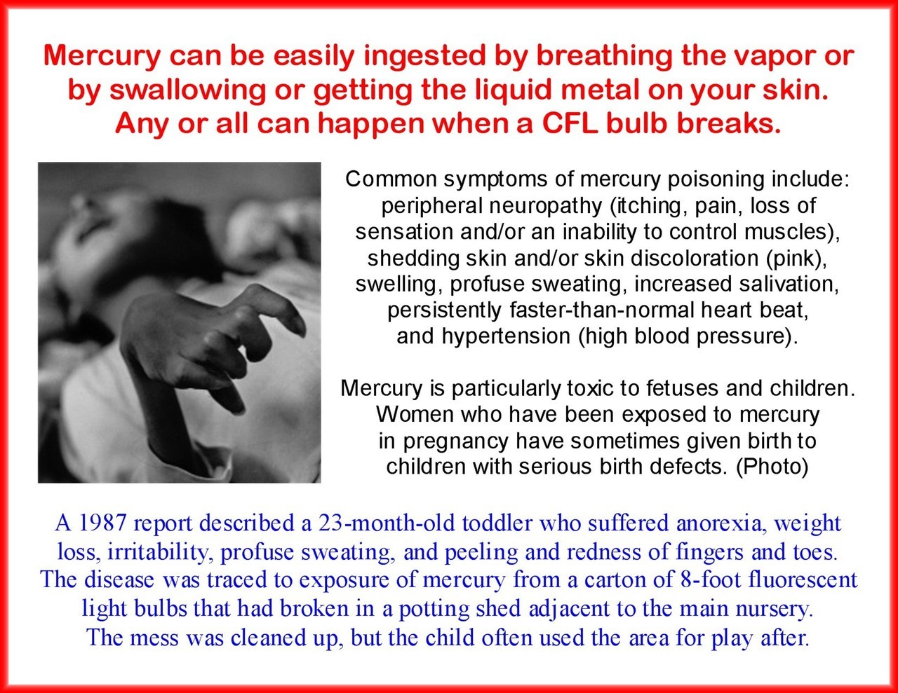 What to do if poisoning with mercury vapor Is it generally treated What to do if poisoning with mercury vapor Is it generally treated