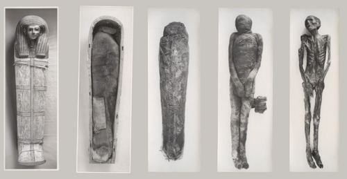 oldroze:oldroze:Unwrapping of a Mummy, 1935–36 seasonHarry...