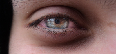 Rojos drogado como los como poner ojos