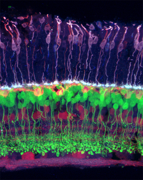 a-fractured-reality-retinal-neurons-the-mature-retina-contains-five