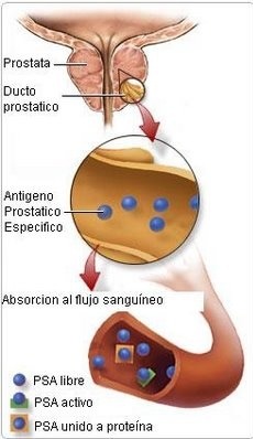 antígeno prostático específico que es para